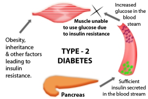 diabetes-type2